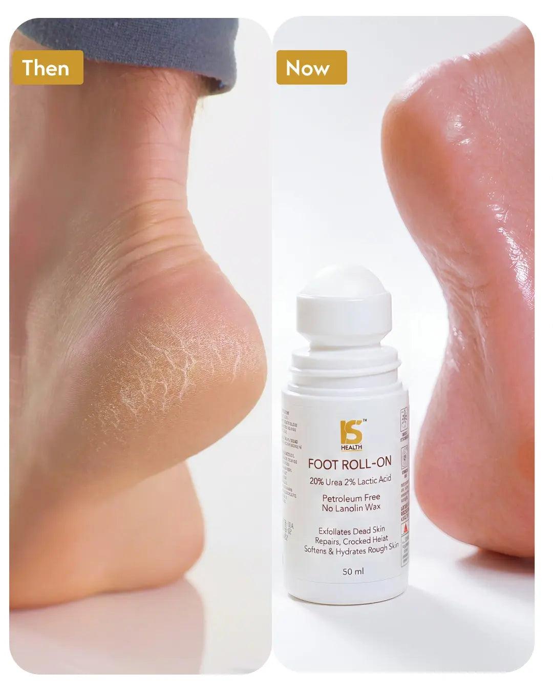 Foot Roll-On with 20% Urea & 2% Lactic Acid