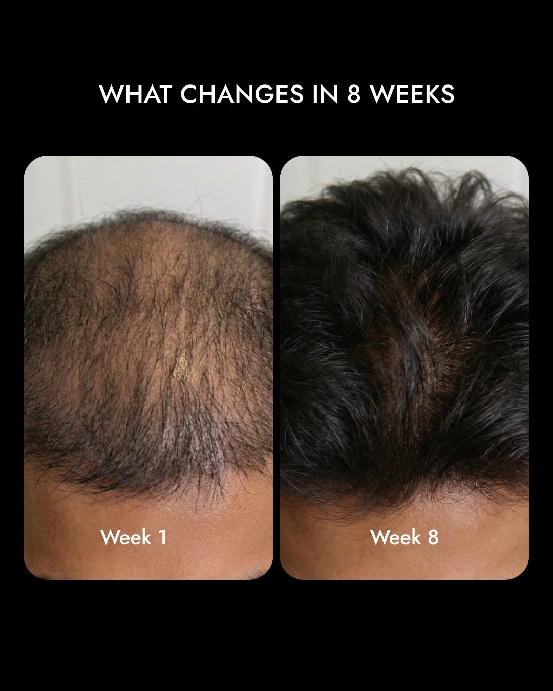 8-Week Advanced Hair Growth Serum