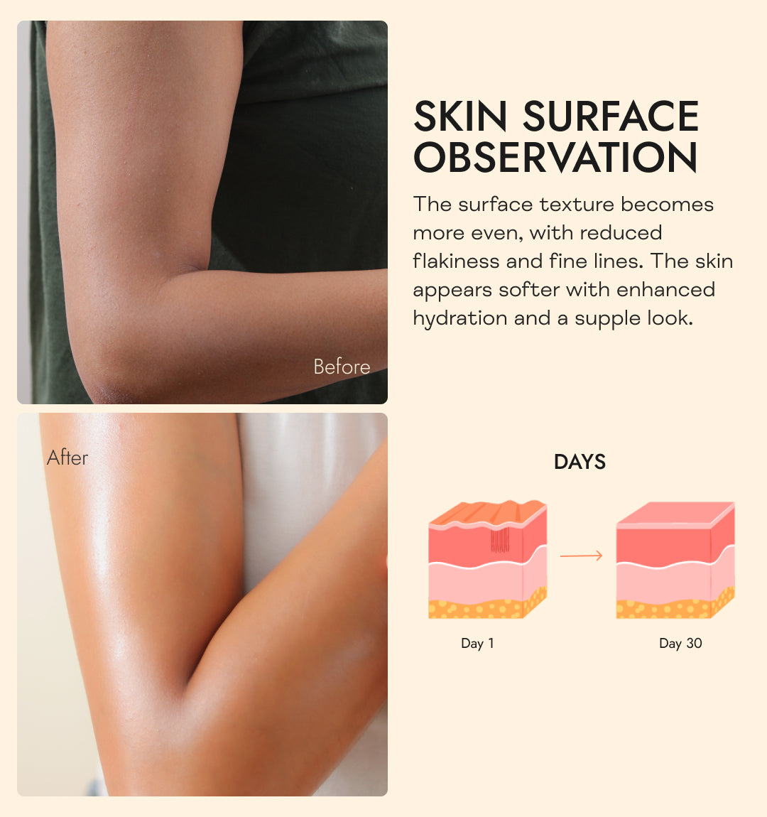 India's First Urea 10% Lotion with bioactive Ceramides